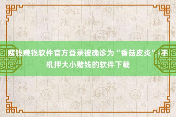 赌钱赚钱软件官方登录被确诊为“香菇皮炎”-手机押大小赌钱的软件下载